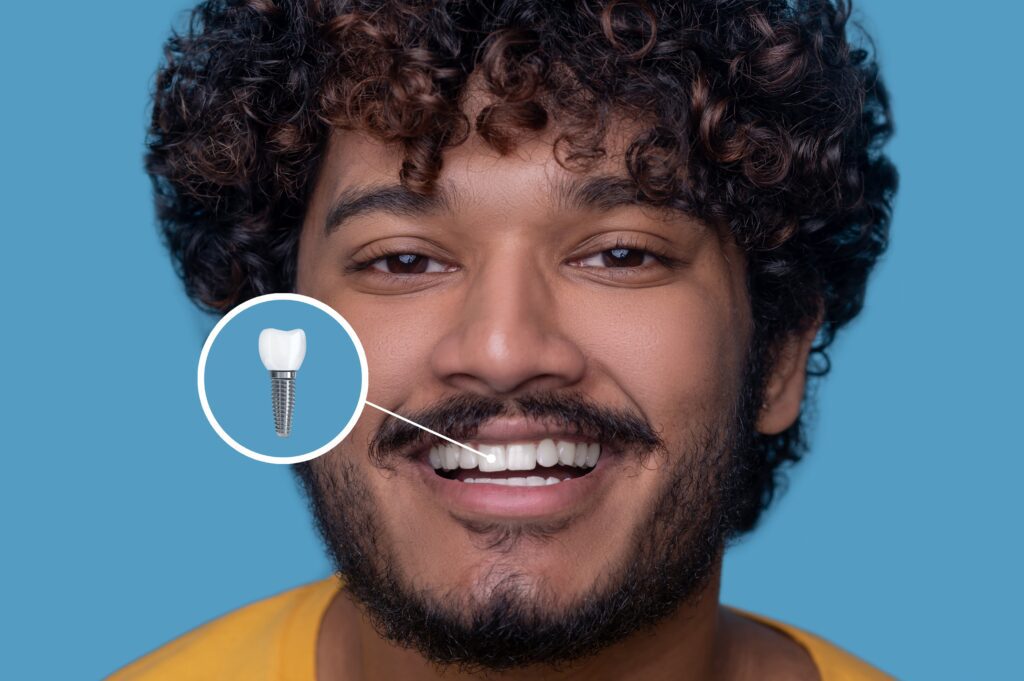 dental implants in Garland