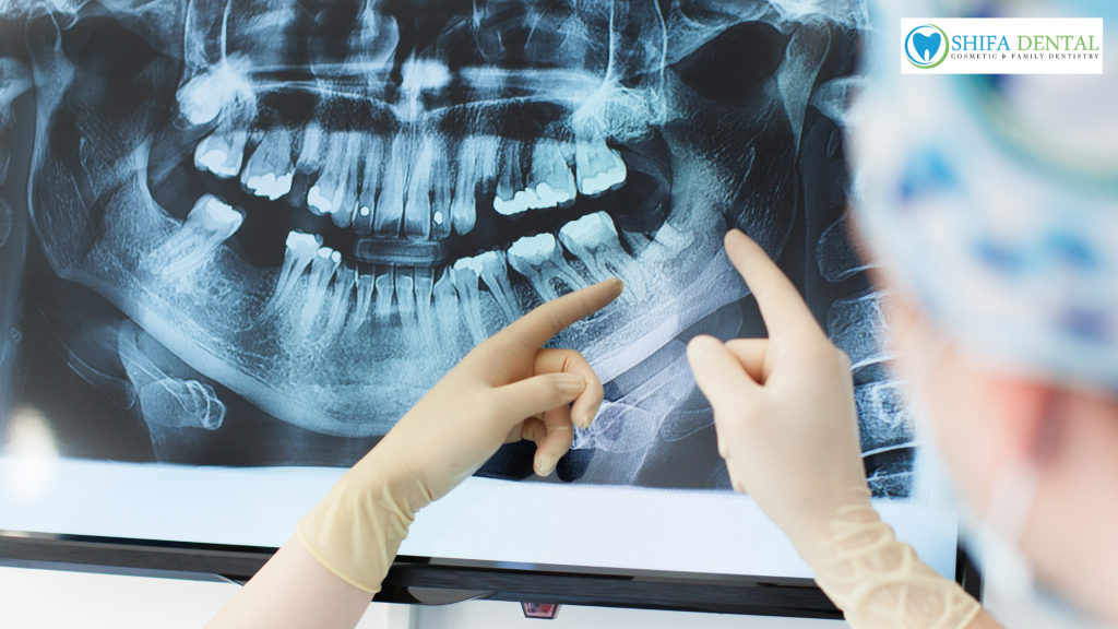 dental X-rays in Garland TX