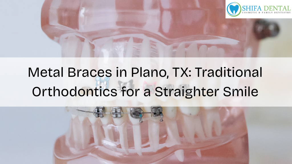 Metal Braces in Garland TX