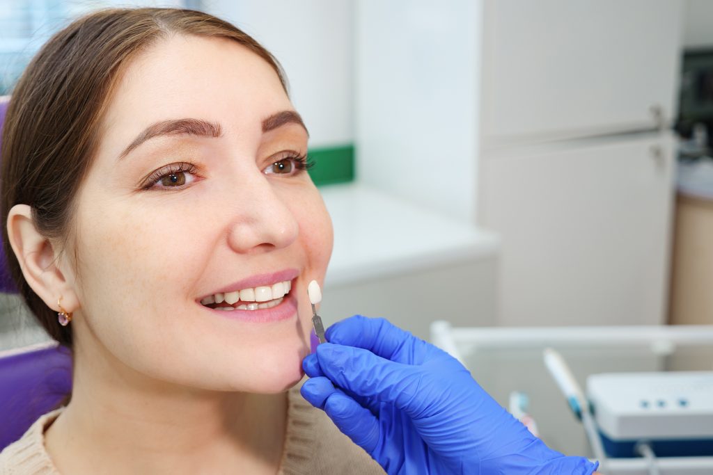 porcelain-veneers-in-plano-tx