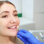 porcelain-veneers-in-plano-tx