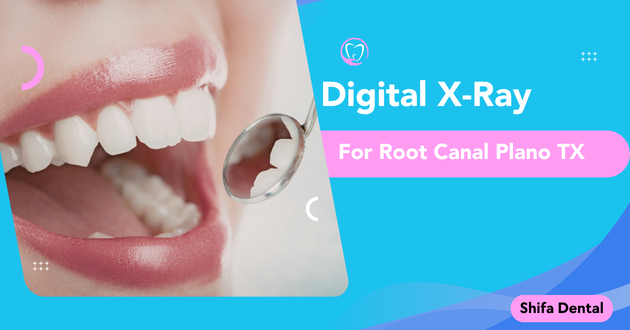 Digital X-Ray for Root Canal Plano TX