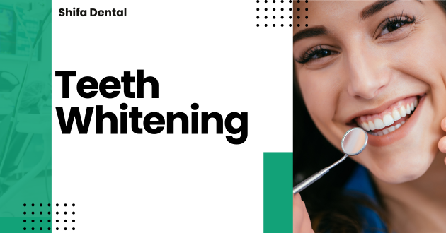 What Is Teeth Whitening?